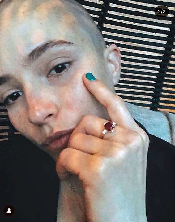 קורנובסקי והקרחת, מתוך האינסטגרם